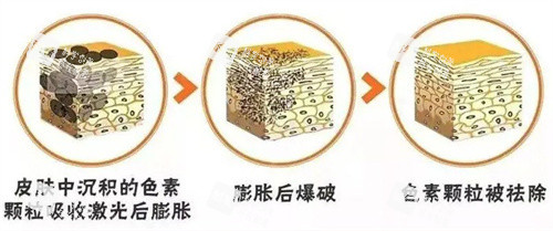 超皮秒原理.jpg