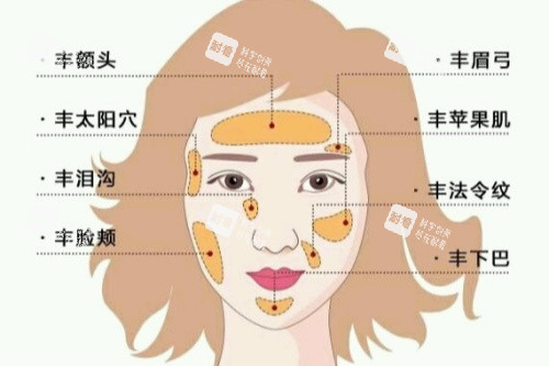 自体脂肪面部填充卡通图.jpg