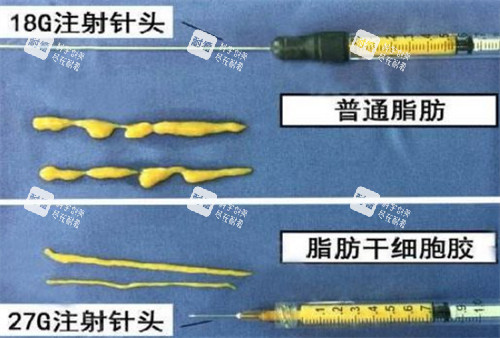 自体脂肪填充需要的脂肪提纯后的样子图片.jpg