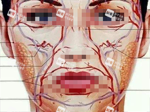 玻尿酸栓塞静脉动脉展示图.png 玻尿酸栓塞静脉动脉展示图.png