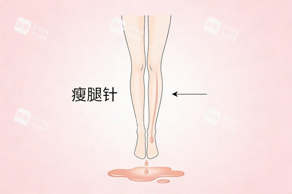 注射针剂瘦腿卡通图展示.jpg