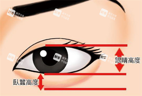 卧蚕注射高度要求细节.jpg 卧蚕注射高度要求细节.jpg