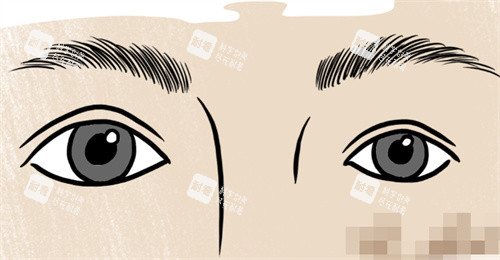 双眼皮大小眼修复.jpg 双眼皮大小眼修复.jpg