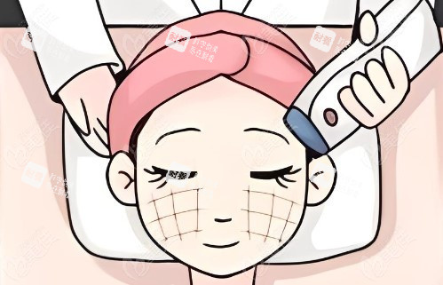 热玛吉操作过程.jpg