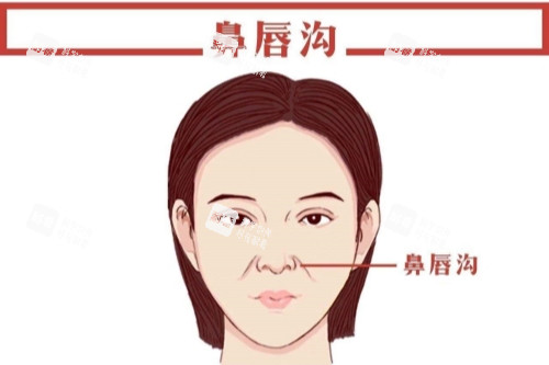 鼻唇沟卡通图.jpg