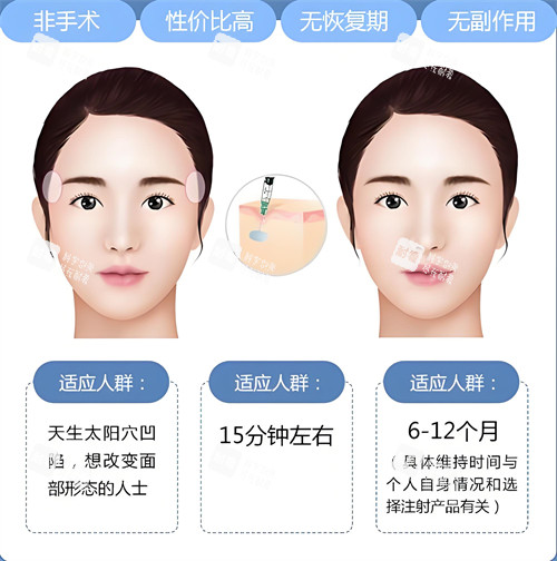 玻尿酸注射填充适合人群与原理动画图.jpg 玻尿酸注射填充适合人群与原理动画图.jpg
