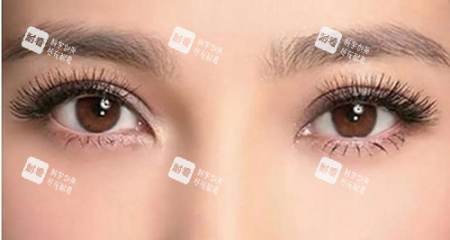 开眼角.webp.jpg 开眼角.webp.jpg