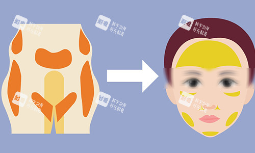 脂肪填充动画图.jpg 脂肪填充动画图.jpg