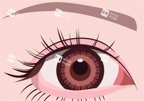 双眼皮动画图.png 双眼皮动画图.png