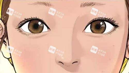 自然双眼皮.png 自然双眼皮.png