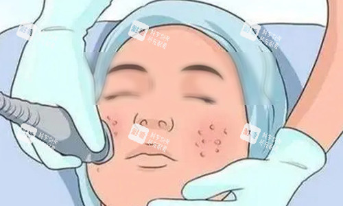 超声炮的操作动画示意图.jpg 超声炮的操作动画示意图.jpg