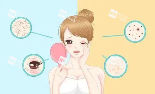 脸部有问题的示意图.jpg