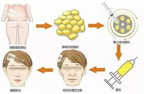 面部填充步骤图.png 面部填充步骤图.png