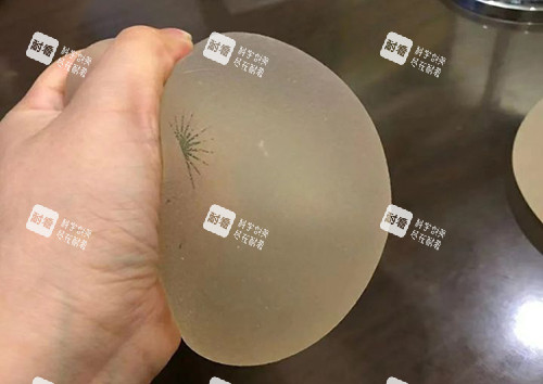 丰胸手术傲诺拉璀璨揉捏展示图.jpg
