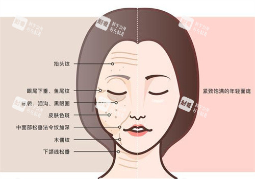 面部抗衰前后.jpg