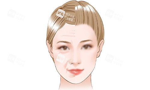 面部抗衰老的意义.jpg