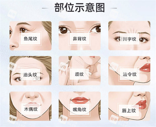 面部除皱部位演示动画图.jpg