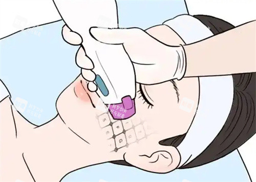面部热玛吉卡通图片.jpg 面部热玛吉卡通图片.jpg