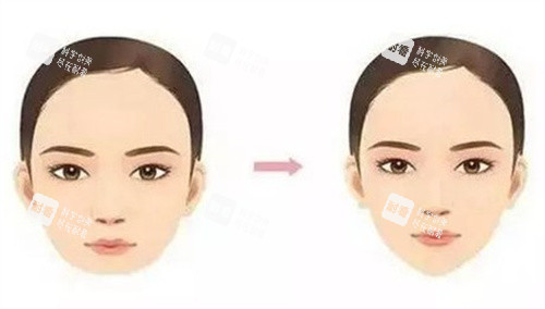垫下巴对比图.jpg