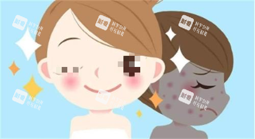 光子嫩肤成效图.png 光子嫩肤成效图.png