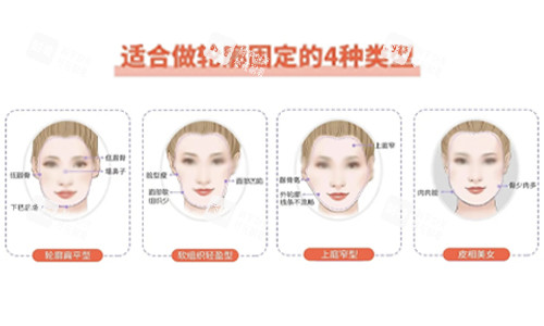 面部轮廓固定适合类型.jpg