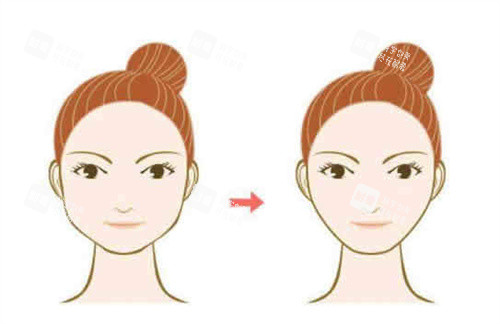 面部轮廓整形卡通图.jpg 面部轮廓整形卡通图.jpg