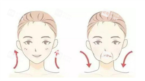 面部提升.jpg 面部提升.jpg