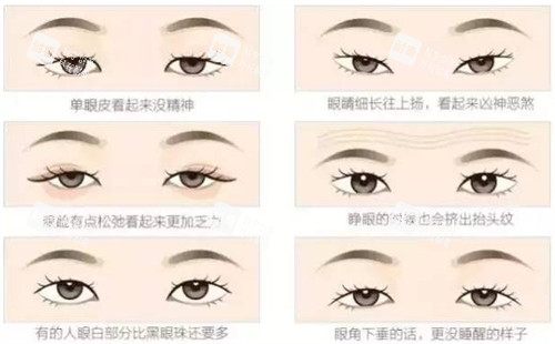 不同可以进行双眼皮的眼睛.jpg 不同可以进行双眼皮的眼睛.jpg