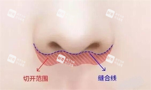 人中缩短卡通图展示.jpg
