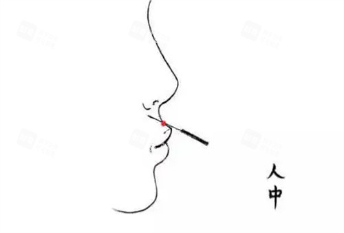 人中加深玻尿酸.jpg