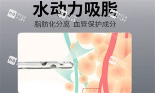 水动力吸脂.jpg 水动力吸脂.jpg