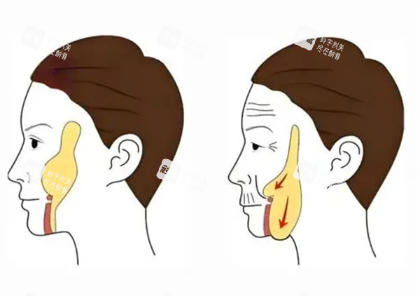 面部轮廓整形卡通图片.jpg