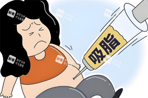 非正规吸脂术.jpg
