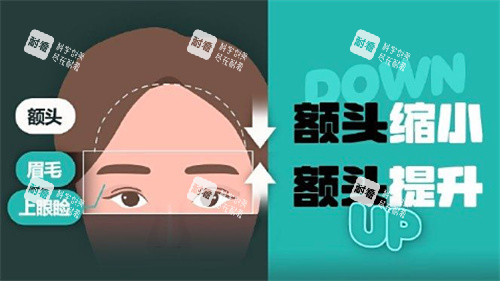额头缩小和额头提升卡通.jpg