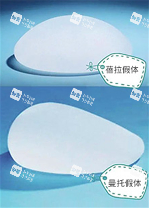 ‌蓓拉假体和曼托假体.jpg