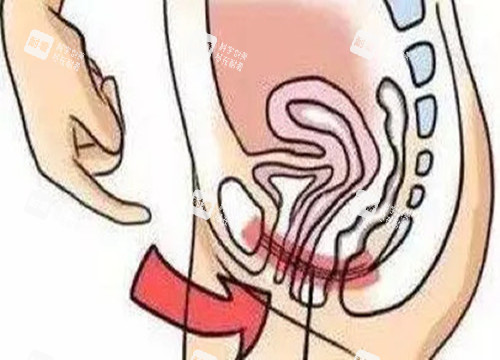 女性私密整形位置示意图.jpg 女性私密整形位置示意图.jpg