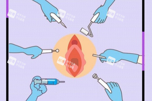 私密整形卡通图.jpg 私密整形卡通图.jpg