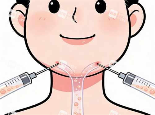 面部吸脂示意图.png