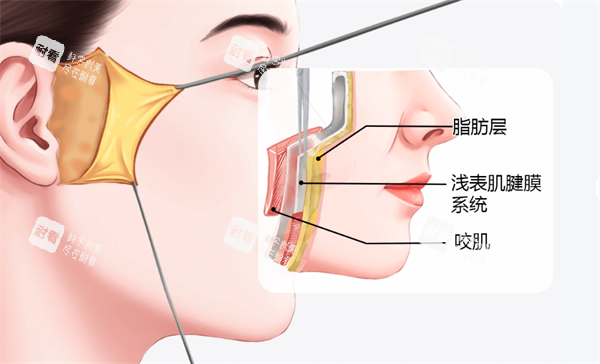面部拉皮层次.png