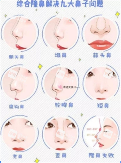 隆鼻.jpg 隆鼻.jpg