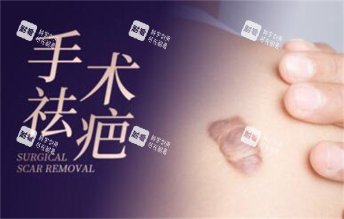 手术疤痕祛除改善图.jpg 手术疤痕祛除改善图.jpg