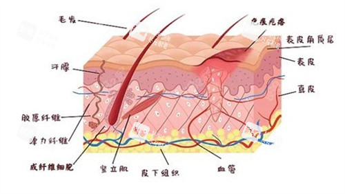 疤痕增生原理.jpg 疤痕增生原理.jpg
