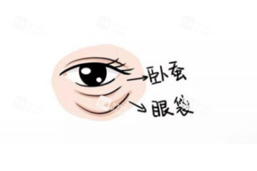 卧蚕、眼袋区别图.jpg