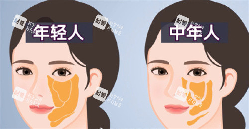 面部脂肪室对比.jpg
