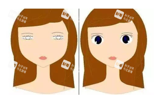 眼皮松弛做双眼皮对比图.jpg
