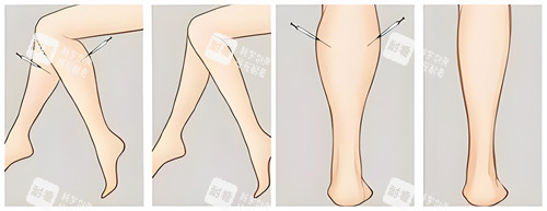 腿部吸脂手术前后对比动画图.jpg 腿部吸脂手术前后对比动画图.jpg