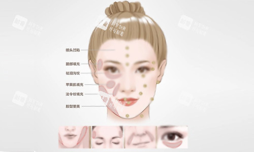 填充部位示意图.jpg 填充部位示意图.jpg