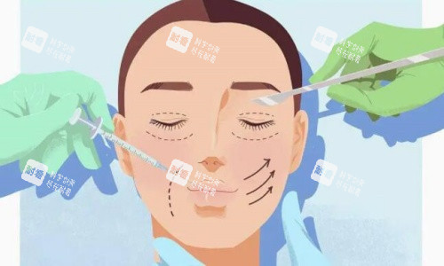 双眼皮手术操作示意图.jpg 双眼皮手术操作示意图.jpg