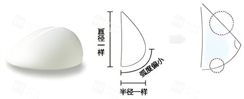 假体隆胸水滴形.jpg 假体隆胸水滴形.jpg