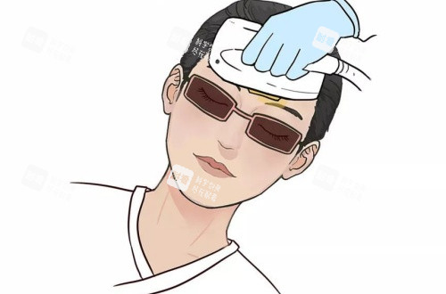 激光美白漫画示意图.jpg 激光美白漫画示意图.jpg